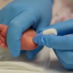 tamizaje neonatal