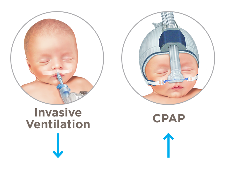 SISTEMA CPAP DE BURBUJAS - UcinMedica - Evolucionamos juntos por la salud